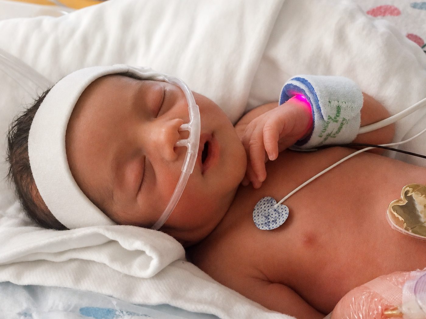 A newborn resting in a NICU bed